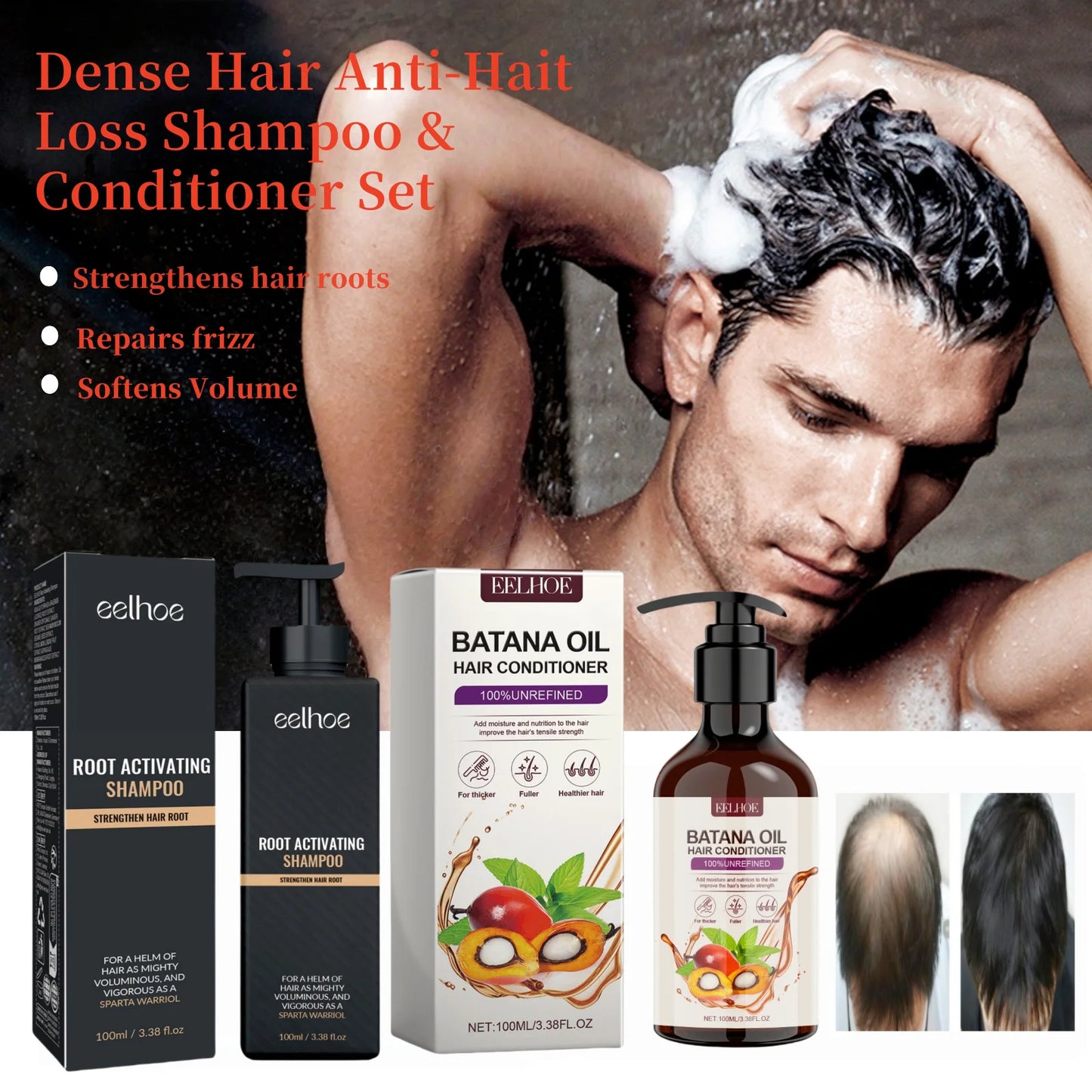 EELHOE  Hair Loss Shampoo & Batana Conditioner Set Strengthening Density Repair Frizz Control Treatment Thinning Damaged Frizzy