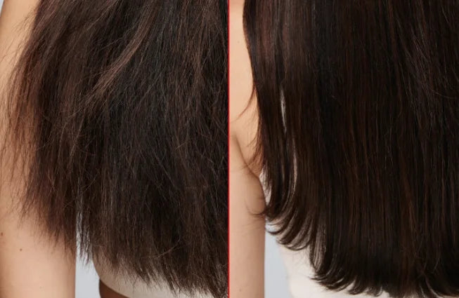 EELHOE  Hair Loss Shampoo & Batana Conditioner Set Strengthening Density Repair Frizz Control Treatment Thinning Damaged Frizzy