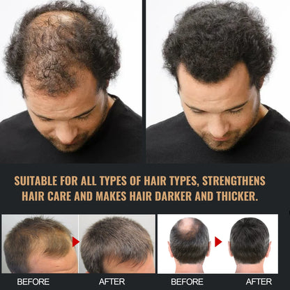 EELHOE  Hair Loss Shampoo & Batana Conditioner Set Strengthening Density Repair Frizz Control Treatment Thinning Damaged Frizzy